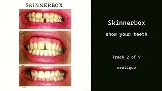 Skinnerbox &ndash; erotique