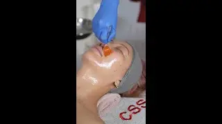 Circadia Lactic Acid Peel