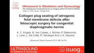 Collagen plug placement after fetoscopic surgery