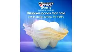 Crest 3DWhite Brilliance Review: Does This Deep Stain Remover Really Deliver Fast Results?