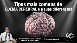 Tipos mais comuns de edema cerebral a suas diferen&ccedil;as