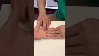 Volar Retinacular Cyst #drleesengkhoo #physiotherapy