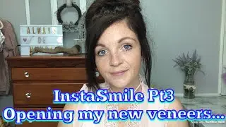 InstaSmile Pt3 - My NEW  Platinum A1 Veneers