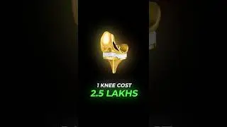 Cost of Robotic Knee Replacement in India | Gold Knee Implant- Dr. Sandeep Singh, Orthopedics