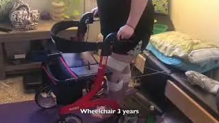 CRPS Complex Regional Pain Syndrome Miracles!