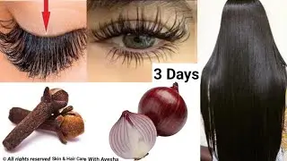 Fast Thick Eyelashes Growth with Onion & Cloves!🤩Eyelash Growth Hack You Must Try!