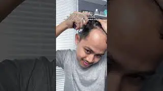 Hairtonic dari bonvie, untuk mengurangi rambut rontok #haircare #hairtonic #shopeehaul #ytshopping25