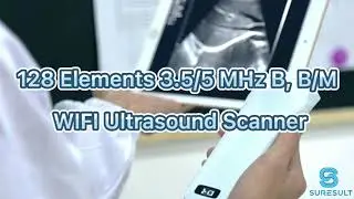 Wireless Convex B/BM Ultrasound Probe Ultrasound Machine for Obstetrics / Gynecology Cheap Price