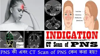 Video No:023. CT PNS কী? CT PNS কী কারনে করা হয়? INDICATION OF CT PNS.CT Scan of PNS.