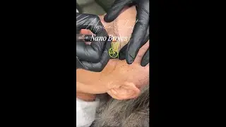 Nano Brow Machine Hairstroke on Alopecia Client