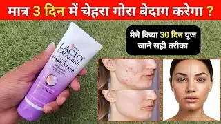 Lacto calamine face wash | beat face wash | lacto calamine face wash review 