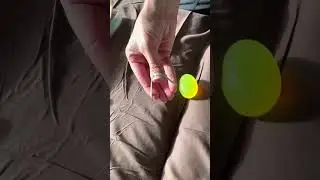 Finger and Thumb Extension Strengthening with Rubber Band.