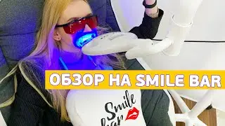 Отбеливание зубов: ОБЗОР НА smile bar в Минске! Опасно ли? Отбелили зубы!
