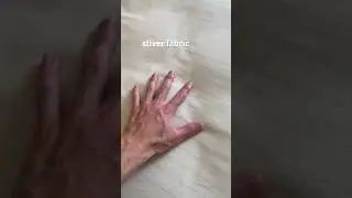 Try grounding bed sheets