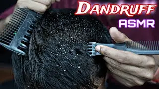 Dandruff Scratching ASMR | Heavy Oil Massage | Live Scratching ASMR Massage | Tapping & Scratching