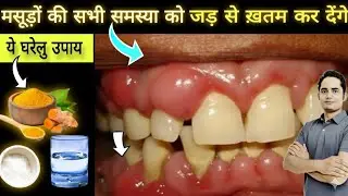 Masudon Ki Sujan Aur Dard Ka Best Gharelu Ilaj!Ghar Par Masudon Ki Sujan Aur Dard Kaise Thik Karein?
