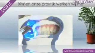 Britesmile