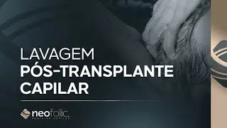 Lavagem pós-transplante capilar