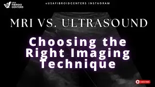 MRI vs Ultrasound: Choosing the Right Imaging Technique