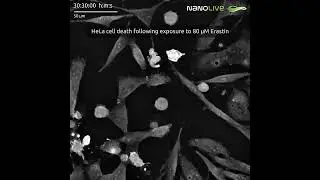 Erastin-induced cell death in HeLa cells with Nanolive imaging