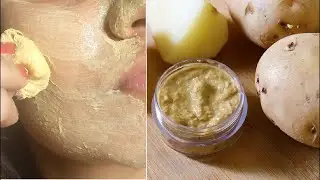 STOP Soap! Apply Potato Face Pack Daily to Remove Dark Spot, Hyperpigmentation,How to Skin Whitening