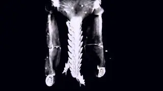 Rendering of the hypostome, chelicerae and palps of a nymphal Ixodes ricinus tick.