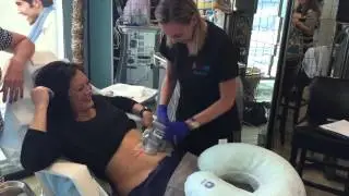 Dr. Richard LeConey Houston Texas coolsculpting treatment