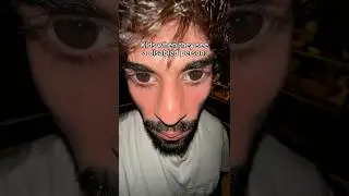 Kids When They See A Disabled Person