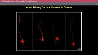 Methods for Culturing Primary Adult CNS Neurons