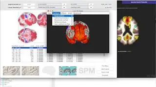 Resting state functional connectivity in CONN (#3)