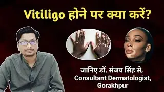 What should I do if I have vitiligo? What treatment should I follow? Dr. Sanjay Singh, MD Dermato...