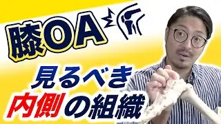 【膝治療】膝OAで絶対見るべき内側の組織