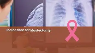 Mastectomy