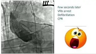 CVI 2019_Friday 7/19_ The Boundaries of Structural Heart Therapy I_Alok Sharma, MD