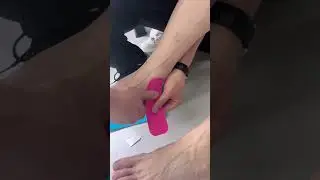 Using kinesiology tape can help prevent heel injuries and relieve heel pain