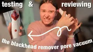 TESTING & REVIEWING the BLACKHEAD REMOVER PORE VACUUM 2021♡