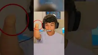 ESSE GAROTO GANHOU UM BRA&Ccedil;O ESTILO CYBERPUNK 🦾🤖