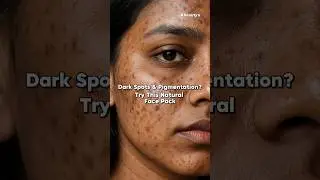 Dark Spots & Pigmentation? Try This Natural Face Pack #shorts #facepack #darkspots #pigmentation