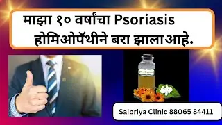 My 10 year old psoriasis cured by Homeopathy |माझ्या १० वर्षांच्या सोरायसिस होमिओपॅथीने बरा झाला.