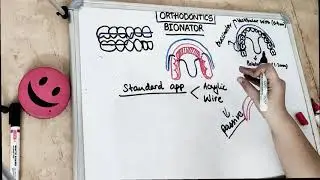 bionator appliance in orthodontics I dental lectures
