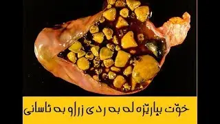خوَت بباريَزه له به ردى زراو به ئاسانى