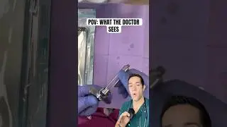 What loading a syringe is really like