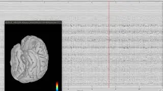 MEG source localization using Brainstorm