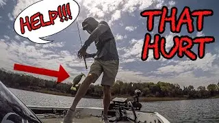 HOOKED IN THE LEG!