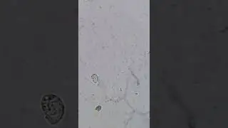 nematodes under the microscope