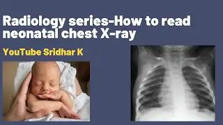 Neonatal radiology-how to read chest X-ray in neonates. The basics. #neonatalradiology #X-ray