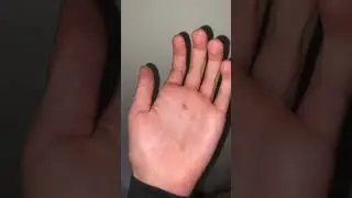 Egg To MASSIVE Crowned Stick Insect 🔥🔥 #insects #stickinsects