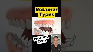 Removable vs Fixed Retainers: Pros & Cons You Need to Know #dentallan #dentist #shorts