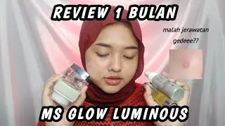 REVIEW 1 BULAN PAKE MS GLOW || MALAH JERAWATAN PARAH? || MS GLOW LUMINOUS