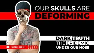 Why We Have Crooked Teeth? | Jaws: The Story of a Hidden Epidemic | Deforming Skulls | Dental Braces